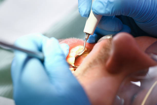 Best Emergency Tooth Extraction  in Kings Bay Base, GA