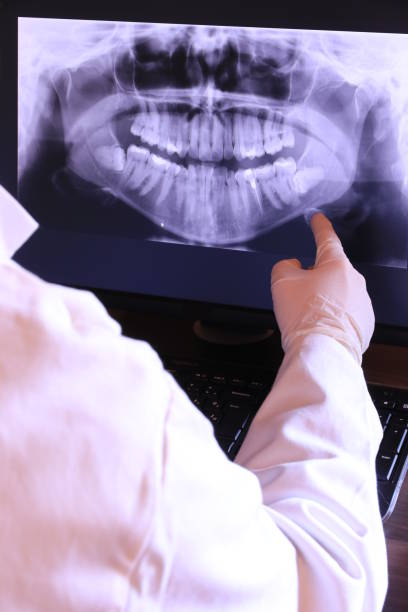 Best Knocked-Out Tooth Emergency  in Kings Bay Base, GA